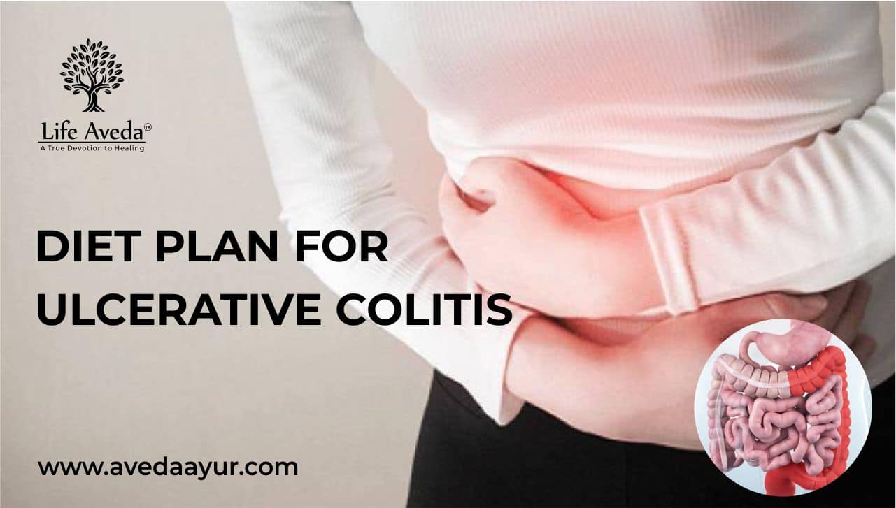 Diet Plan for Ulcerative Colitis