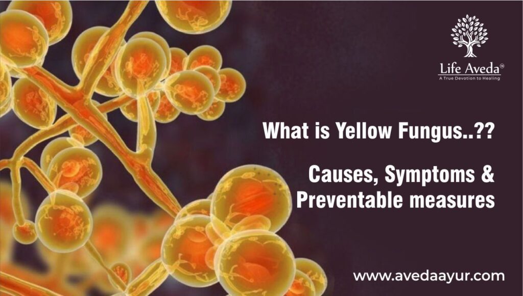 What is Yellow Fungus? Causes, Symptoms and Preventable Measures