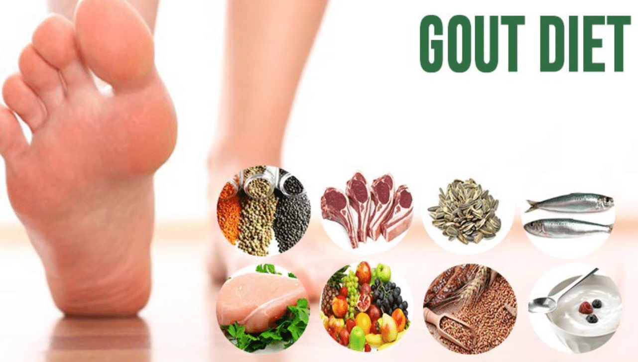 Diet Chart For Gout Patients Foods to consume and avoid