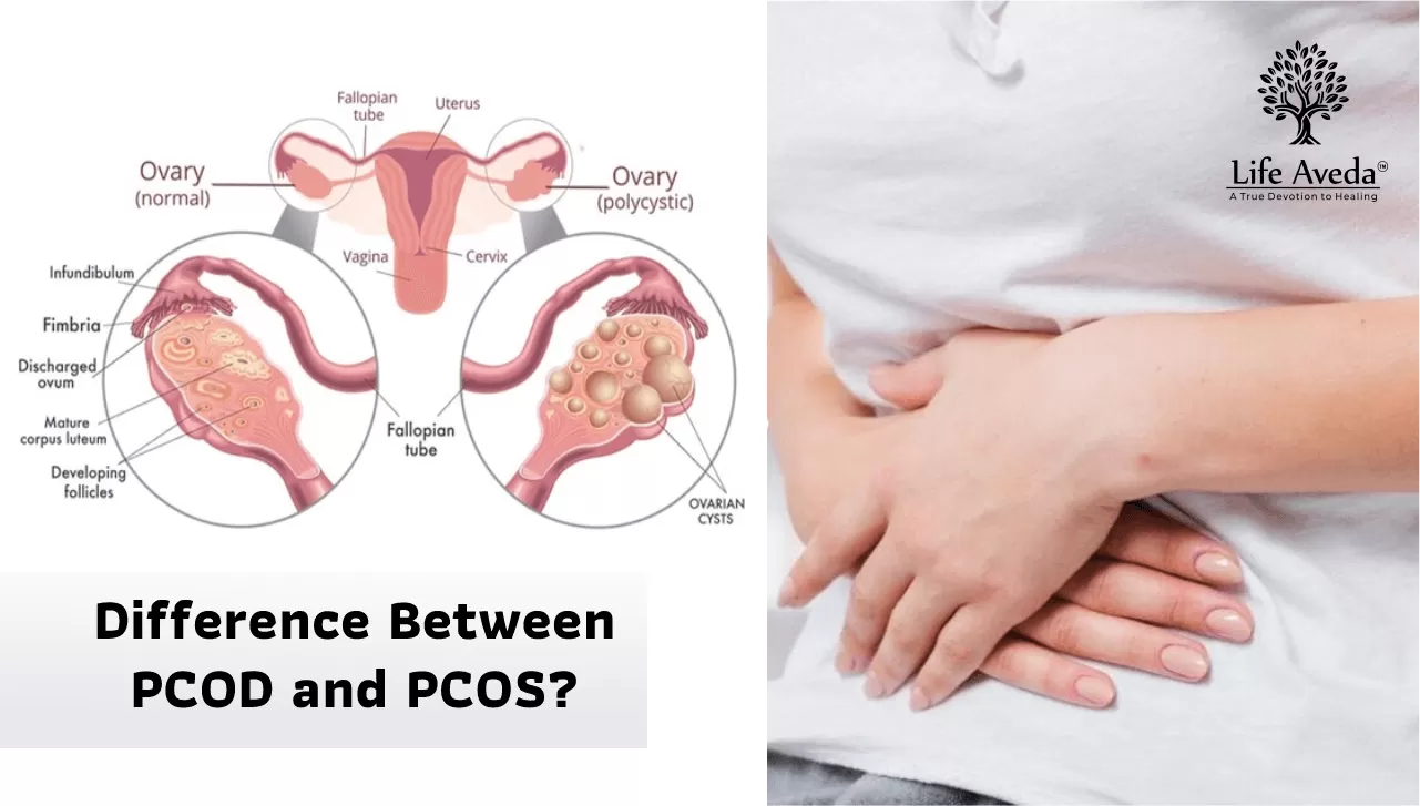 PCOD & PCOS Difference