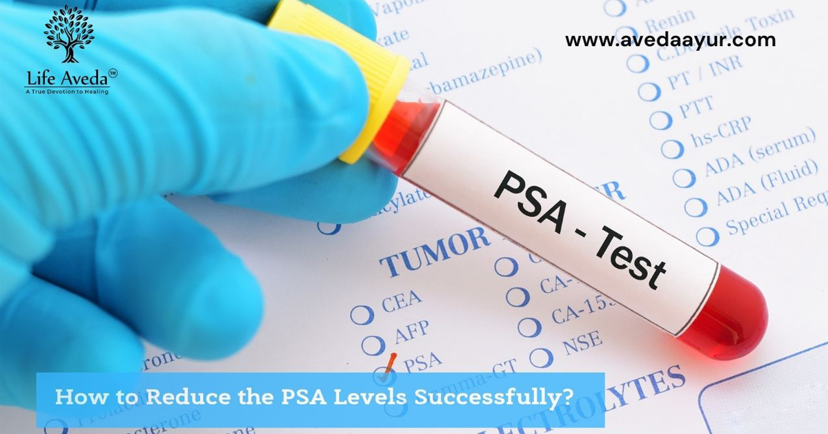 How to Reduce the PSA Levels Successfully?