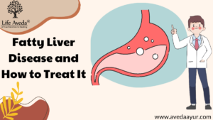 Fatty Liver Disease: What It Is and How to Treat It
