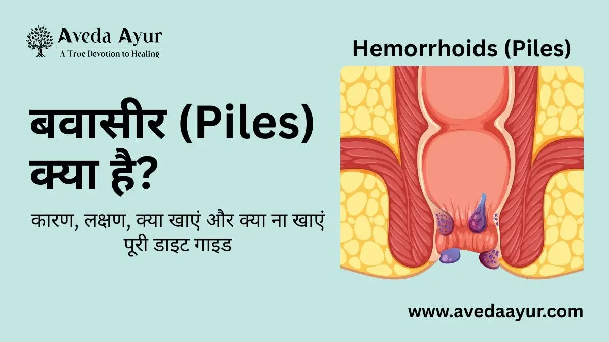 Hemorrhoids (Piles) image